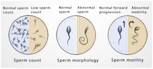 عوامل موثر در تعیین کیفیت اسپرم
