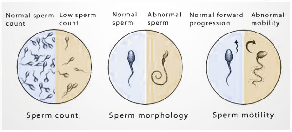 عوامل موثر در تعیین کیفیت اسپرم / اسپرم چیست